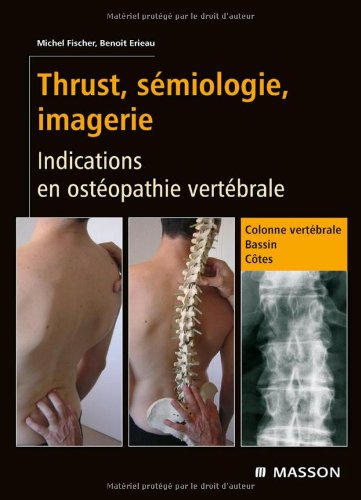9782294708299: Thrust, smiologie, imagerie: Indications en ostopathie vertbrale