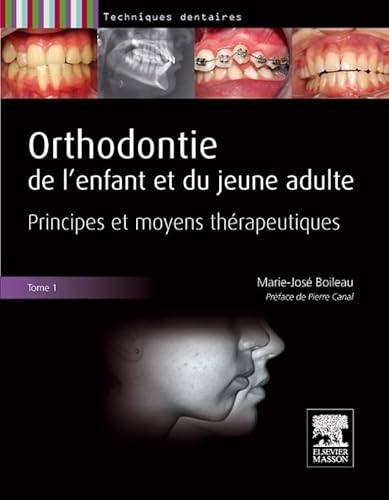 Orthodontie de l'enfant et du jeune adulte. Tome 1: Principes et moyens thÃ©rapeutiques (9782294709234) by Boileau, Marie-JosÃ©