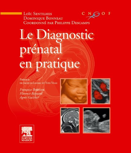 Beispielbild fr Le diagnostic prnatal en pratique zum Verkauf von Revaluation Books