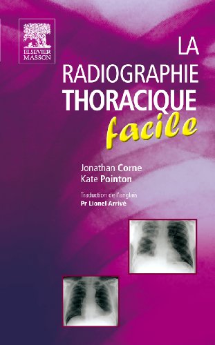 Beispielbild fr La radiographie thoracique facile zum Verkauf von Ammareal