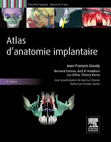 9782294713798: Atlas d'anatomie implantaire