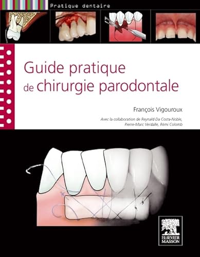 9782294714467: Guide pratique de la chirurgie parodontale