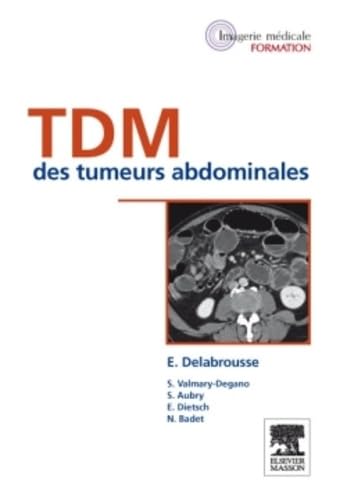 Stock image for TDM des tumeurs abdominales for sale by Gallix