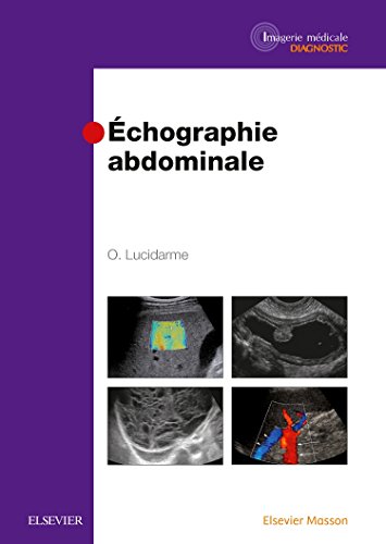 Stock image for Echographie abdominale for sale by medimops