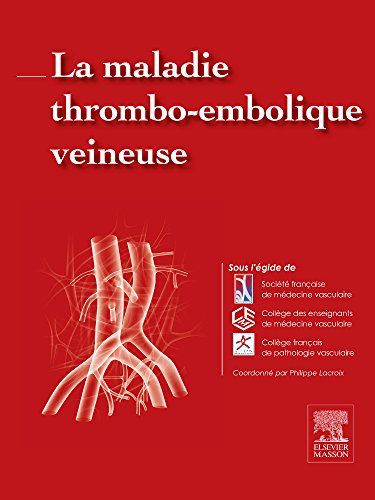 9782294744891: La maladie thrombo-embolique veineuse