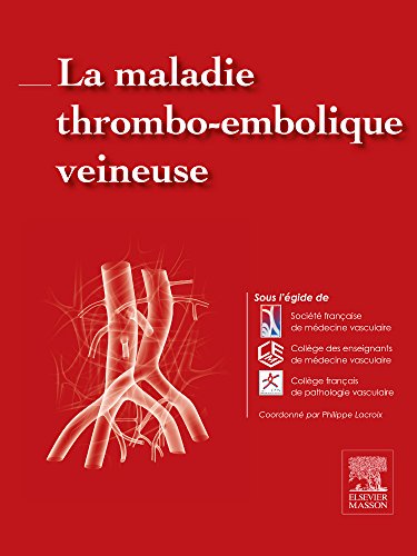 Stock image for La maladie thrombo-embolique veineuse for sale by Gallix