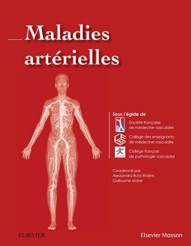 Stock image for Maladies Artrielles (French Edition) for sale by Gallix