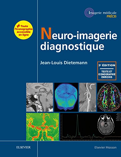 Imagen de archivo de Neuro-imagerie Diagnostique (French Edition) a la venta por Gallix