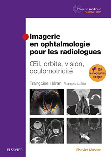 Beispielbild fr Imagerie en ophtalmologie pour les radiologues: Oeil, orbite, vision, oculomotricit zum Verkauf von Books Unplugged