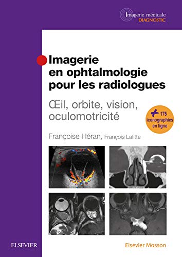 Stock image for Imagerie en ophtalmologie pour les radiologues: Oeil, orbite, vision, oculomotricit for sale by Books Unplugged