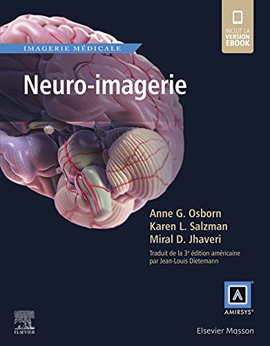 Stock image for Neuro-imagerie (French Edition) for sale by Gallix