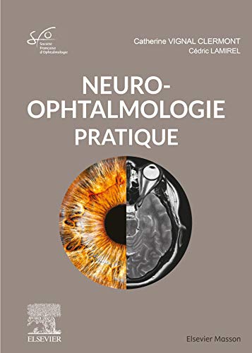 Beispielbild fr Neuro-ophtalmologie pratique: Rapport SFO 2020 zum Verkauf von Gallix
