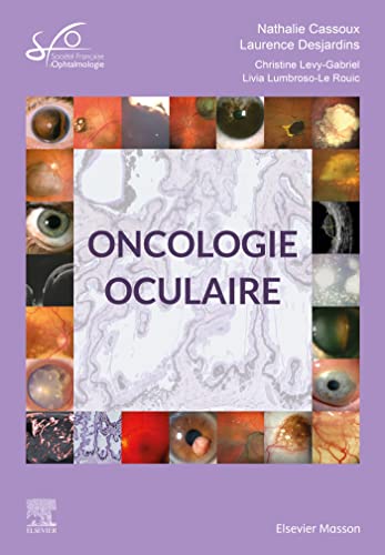 Beispielbild fr Oncologie oculaire: Rapport SFO 2022 zum Verkauf von Gallix