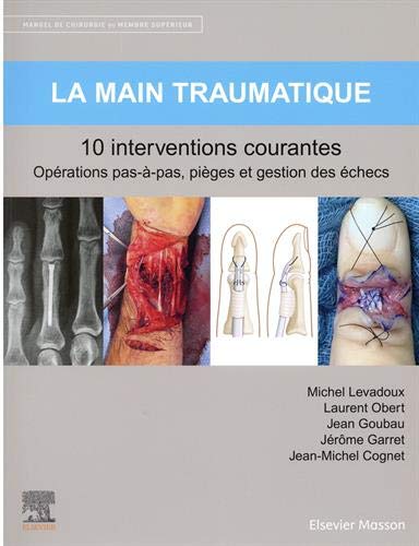 Stock image for La main traumatique 10 interventions courantes: Manuel de chirurgie du membre suprieur for sale by Gallix