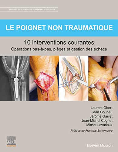Stock image for Manuel De Chirurgie Du Membre Suprieur. Le Poignet Non Traumatique : 10 Interventions Courantes : O for sale by RECYCLIVRE