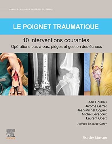 Stock image for Le poignet traumatique 10 interventions courantes: Manuel de chirurgie du membre suprieur for sale by Gallix