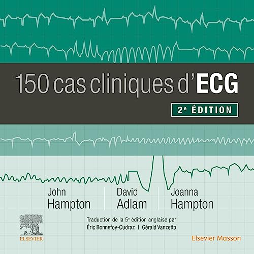 Stock image for 150 cas cliniques d'ECG [Broch] Hampton, John R.; Adlam, David et Hampton, Joanna for sale by BIBLIO-NET