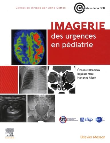 Stock image for imagerie des urgences en pdiatrie for sale by Chapitre.com : livres et presse ancienne