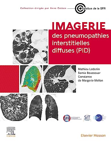 Stock image for Imagerie Des Pneumopathies Interstitielles Diffuses (pid) for sale by RECYCLIVRE