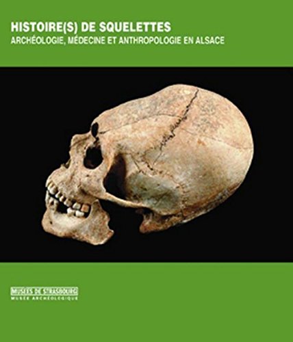 Stock image for Histoire(s) De Squelettes : Muse Archologique for sale by RECYCLIVRE