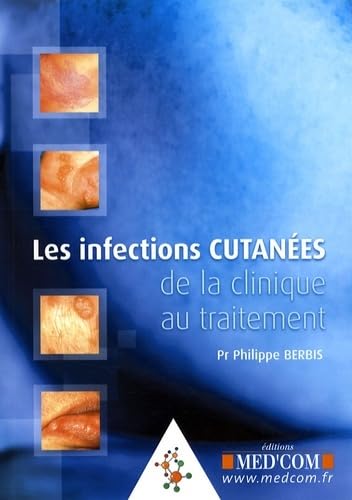 9782354030162: LES INFECTIONS CUTANEES DE LA CLINIQUE AU TRAITEMENT (0000)