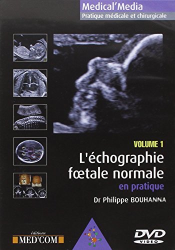 9782354030377: L'Echographie foetale normale en pratique volume 1: DVD vido