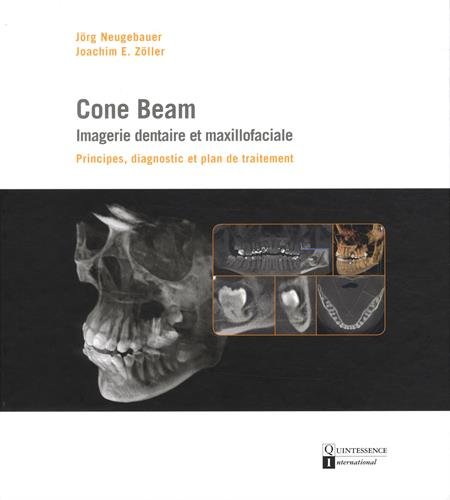 9782366150216: Cone Beam : imagerie dentaire et maxillofaciale: Principes, diagnostic et plan de traitement