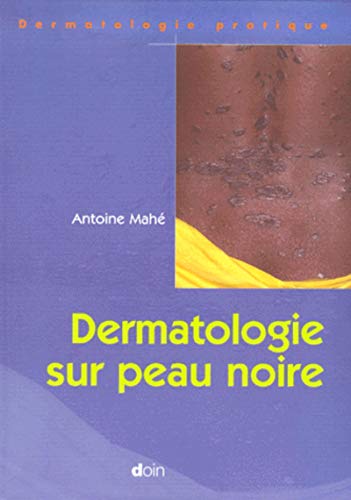 Stock image for Dermatologie sur peau noire for sale by Gallix