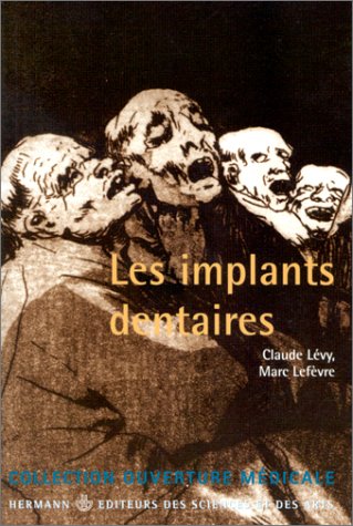 Beispielbild fr Les Implants dentaires zum Verkauf von Ammareal