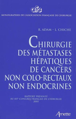 Beispielbild fr Chirurgie des mtastases hpatiques de cancers non colo-rectaux non endocrines zum Verkauf von Ammareal