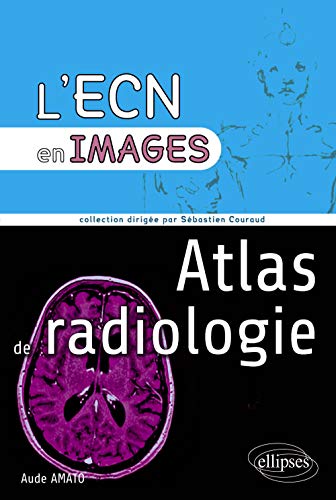 Beispielbild fr Atlas de Radiologie l'ECN En Images zum Verkauf von medimops