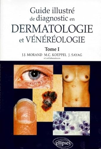 Beispielbild fr Guide illustr de diagnostic en dermatologie et vnrologie zum Verkauf von medimops