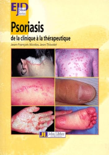 Beispielbild fr Psoriasis : De la clinique  la thrapeutique zum Verkauf von Ammareal