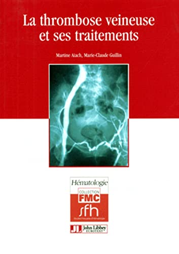 Stock image for Transfusion sanguine for sale by Chapitre.com : livres et presse ancienne