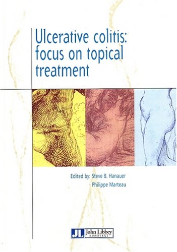 9782742002894: Ulcerative Colitis: Focus on Topical Treatmen