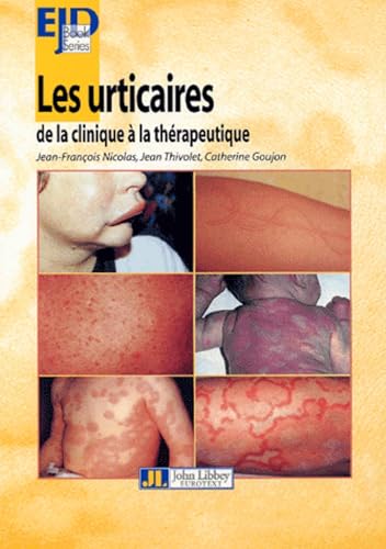 9782742003556: Les Urticaires-De La Clinique A La Therapeutique