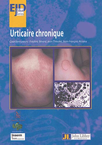 Beispielbild fr Urticaire chronique : Sminaire thmatique de la Coordination d'Allergologie du CHU de Lyon zum Verkauf von Revaluation Books