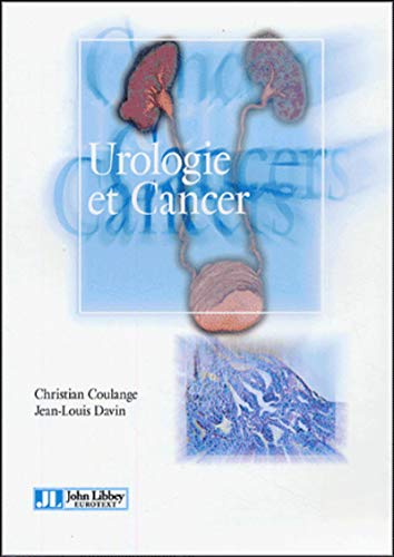 Imagen de archivo de Urologie Et Cancer a la venta por Ammareal