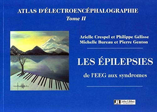 9782742005833: Atlas d'lectroencphalographie: Tome 2, Les pilepsies, de l'EEG aux syndromes