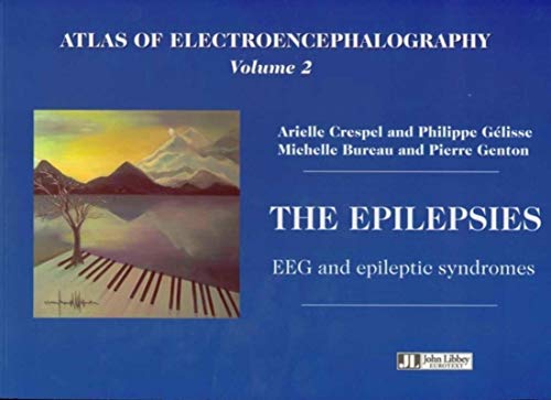 Imagen de archivo de Atlas of Electroencephalography Vol 2. The Epilepsies. EEG and Epileptic Syndromes a la venta por TextbookRush