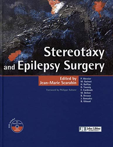 Stock image for Stereotaxy and Epilepsy Surgery - With videos (English and French Edition) for sale by HPB-Red