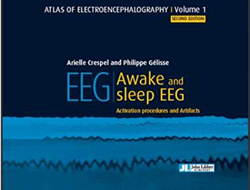 9782742015061: Atlas of electroencephalography - Awake and sleep EEG. Activation procedures and Artifacts. (2nd edition)