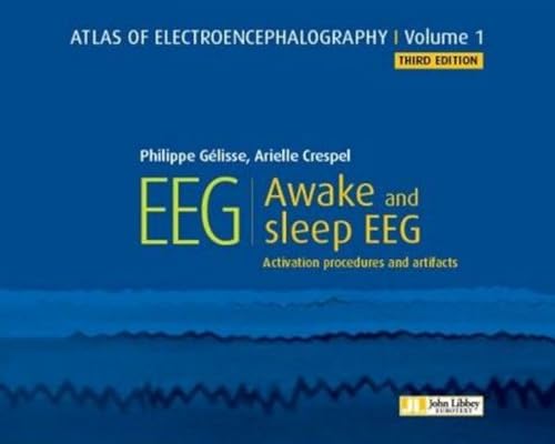 Stock image for Atlas of Electroencephalography. Awake and sleep EEG. Activation procedures and artifacts for sale by HPB-Red