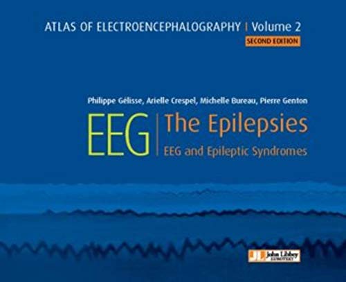 9782742015917: Atlas of Electroencephalography -- Volume 2: The Epilepsies, EEG and Epileptic Syndromes
