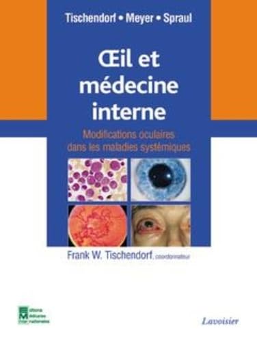 Beispielbild fr Oeil Et Mdecine Interne : Modifications Oculaires Dans Les Maladies Systmiques zum Verkauf von RECYCLIVRE