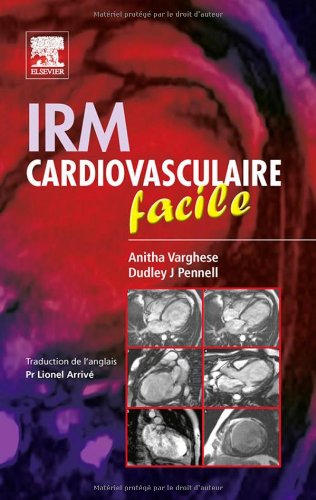 Beispielbild fr IRM cardiovasculaire facile zum Verkauf von MaxiBooks