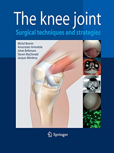 9782817805467: The Knee Joint: Surgical Techniques and Strategies