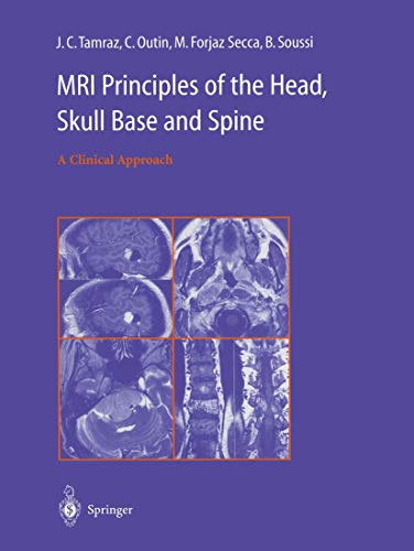 Stock image for MRI Principles of the Head; Skull Base and Spine: A Clinical Approach for sale by Ria Christie Collections