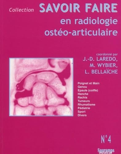 Stock image for SAVOIR FAIRE EN RADIOLOGIE OSTEO-ARTICULAIRE N 4 for sale by Gallix