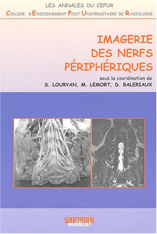 Stock image for IMAGERIE DES NERFS PERIPHERIQUES for sale by Gallix